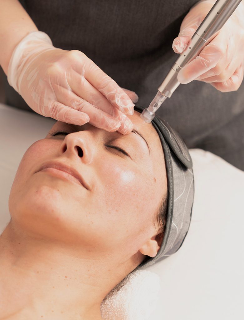 dermalogica microneedling